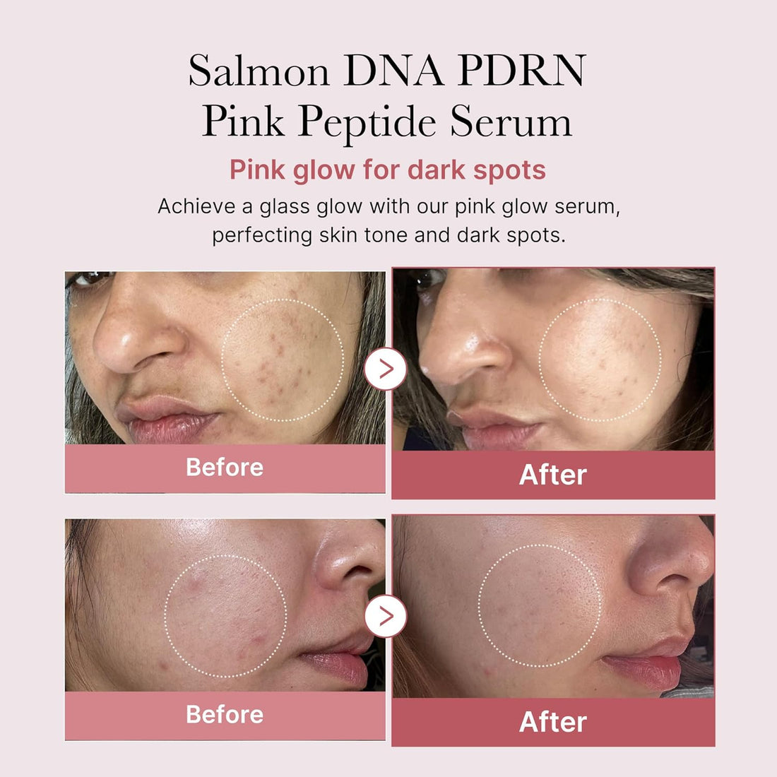 medicube - PDRN Pink Peptide Serum